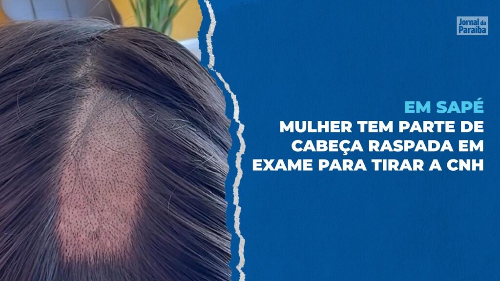 Mulher diz que cabeça foi raspada em exame toxicológico